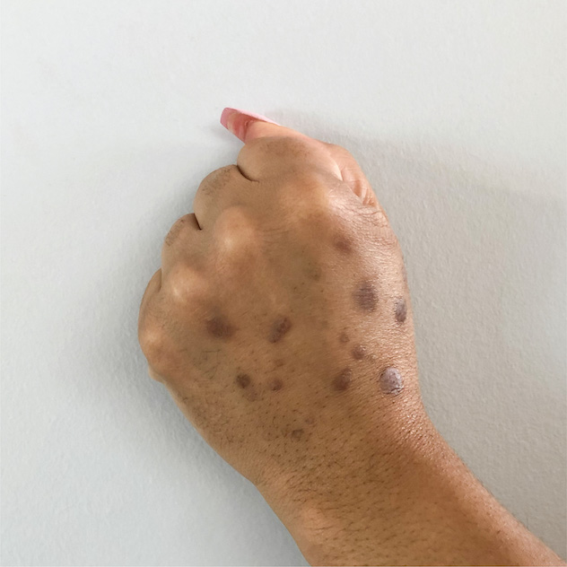 Hover Image
